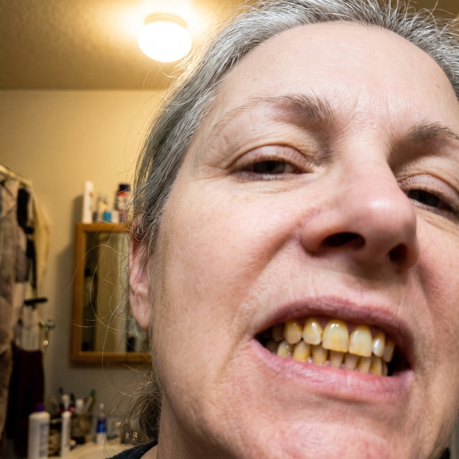 Real photo of yellowed teeth