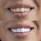 Poudre de blanchiment des dents PAP | Approuvé par le dentiste