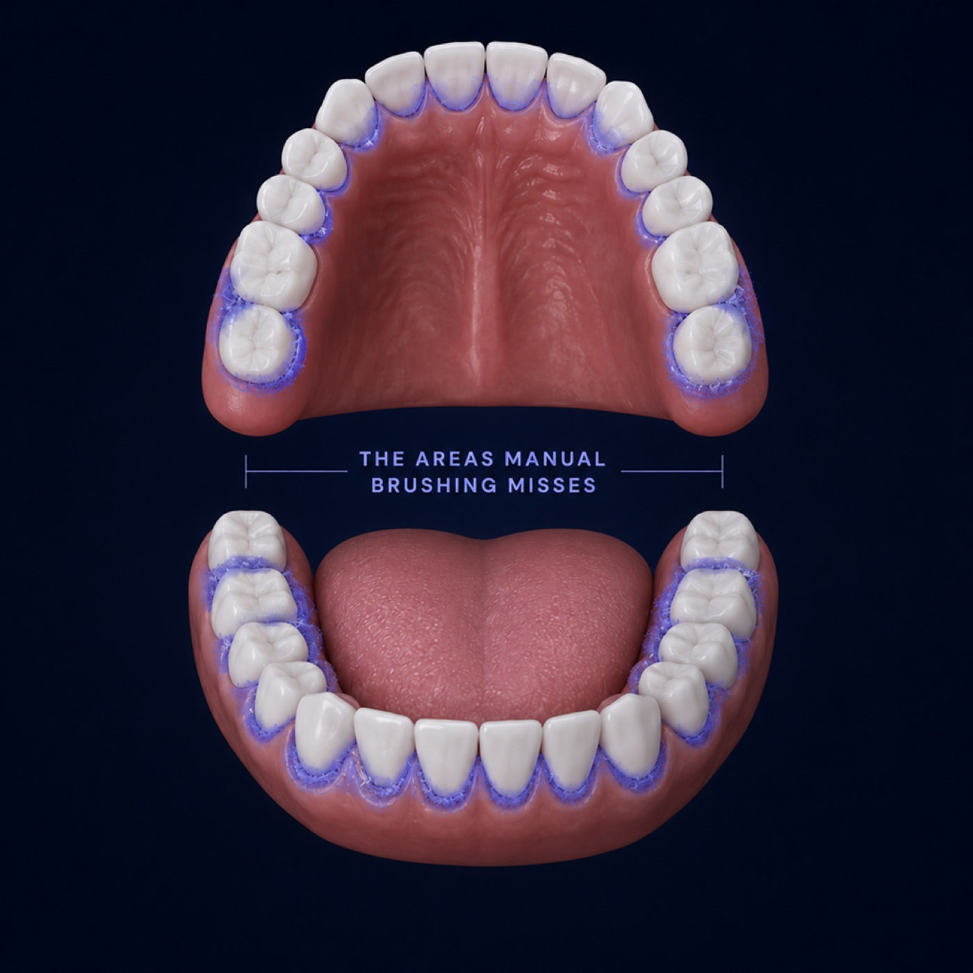 The areas manual brushing misses, highlighted along the gumline