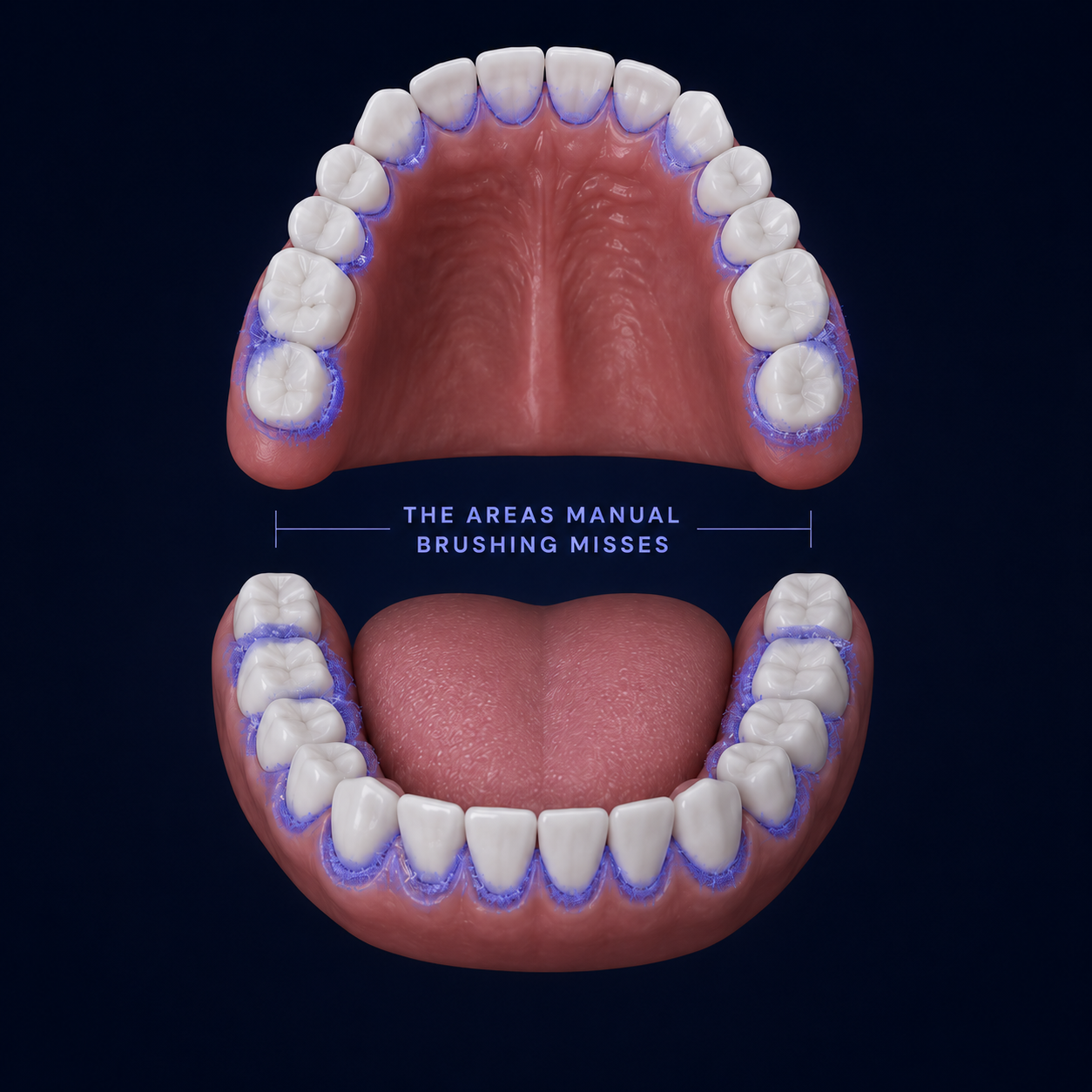 The areas manual brushing misses
