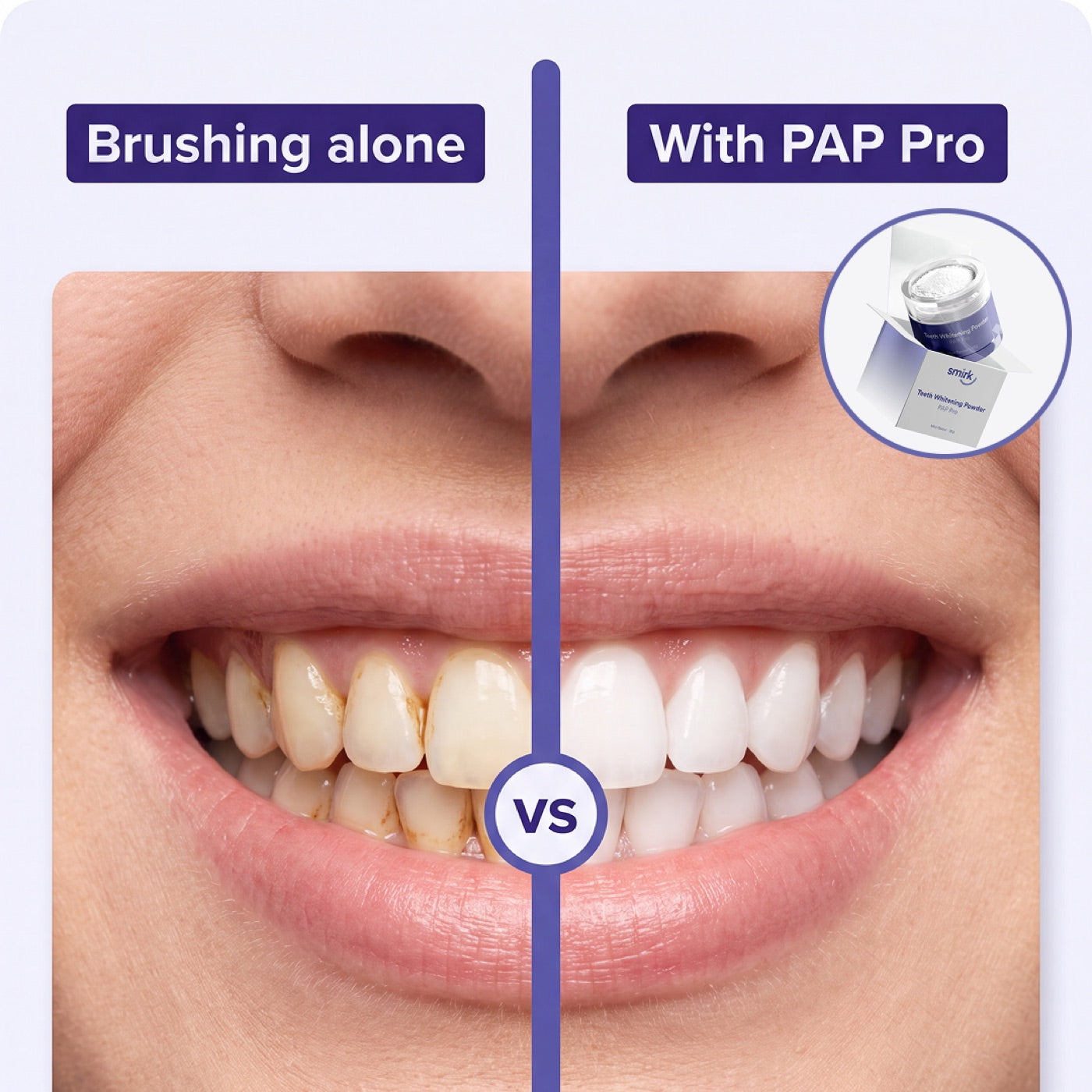 Before and after: brushing alone vs with PAP Pro