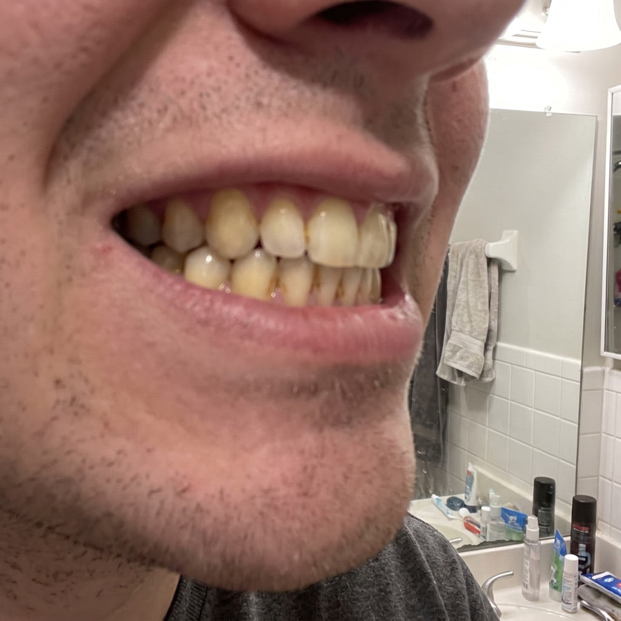 Real photo of yellowed teeth