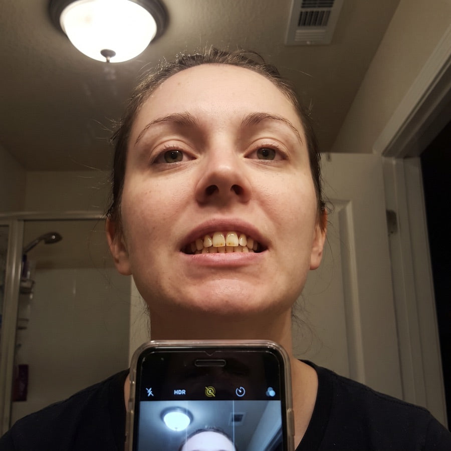 Real photo of yellowed teeth