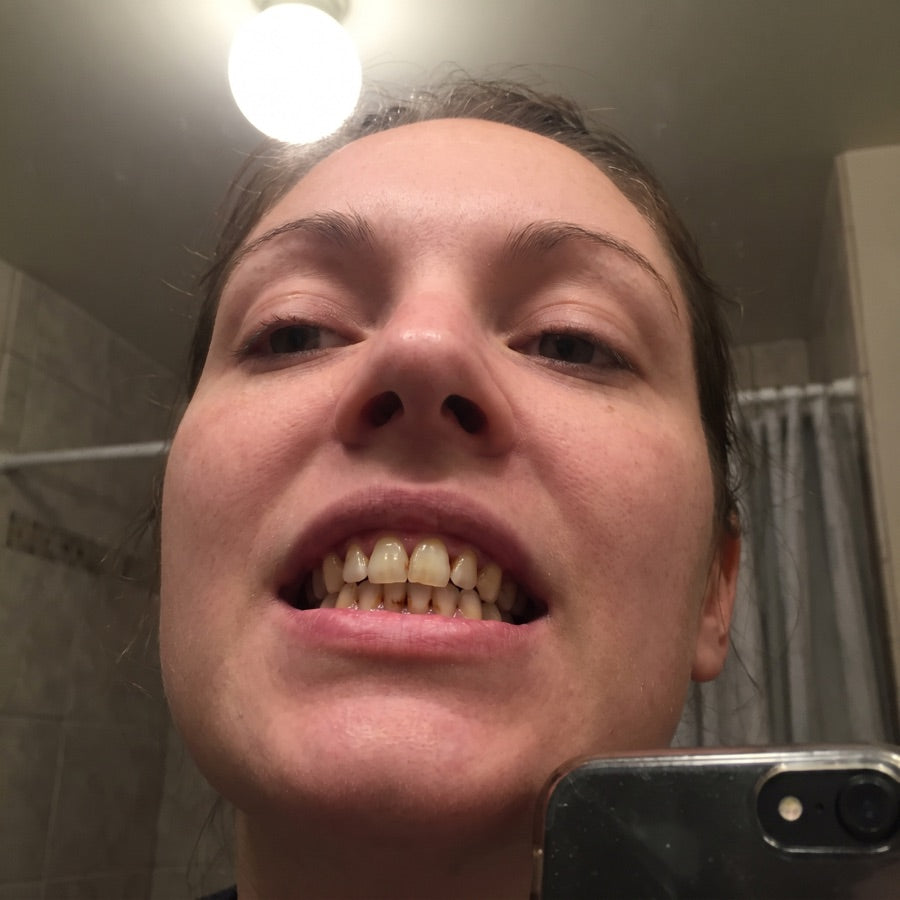 Real photo of yellowed teeth