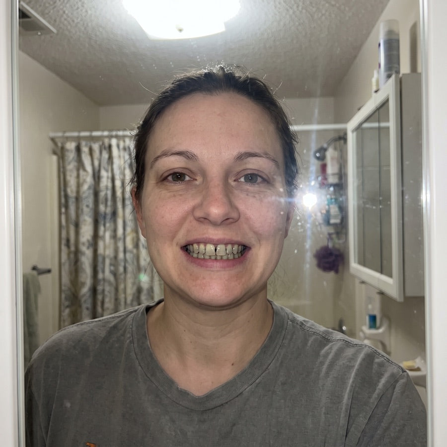 Real photo of yellowed teeth